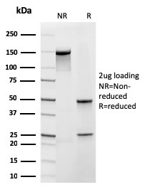 Frataxin Recombinant Monoclonal Mouse Antibody (rFXN/2124)