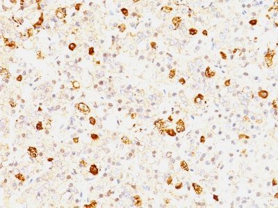 FSH-Beta Monoclonal Mouse Antibody (FSHb/1062)
