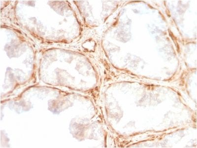 Galectin-1 / Human Placental Lactogen Recombinant Monoclonal Rabbit Antibody (GAL1/2499R)