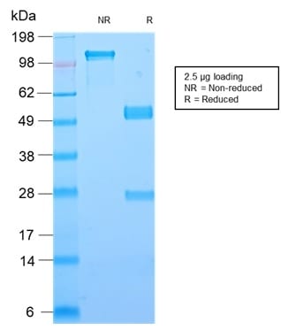 Galectin-1 / Human Placental Lactogen Recombinant Monoclonal Rabbit Antibody (GAL1/2499R)