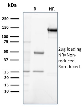 Gastrin Monoclonal Mouse Antibody (GAST/2632)
