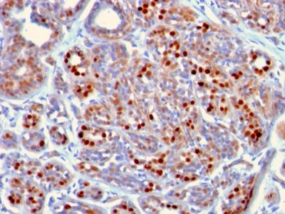 GATA-3 Monoclonal Mouse Antibody (GATA3/2442)