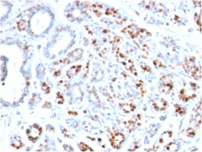 GATA-3 Monoclonal Mouse Antibody (GATA3/2444)
