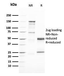 GATA-3 Monoclonal Mouse Antibody (GATA3/2446)