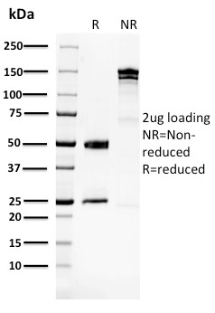 Glucose 6-Phosphate Isomerase Monoclonal Mouse Antibody (CPTC-GPI-1)