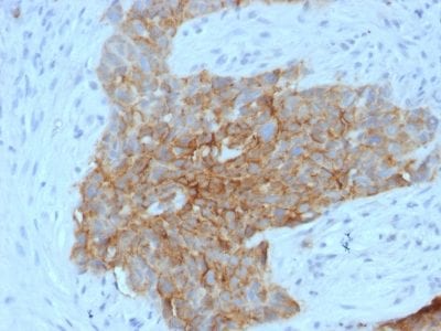 GLUT-1 Monoclonal Mouse Antibody (GLUT1/2475)