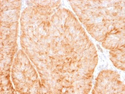 GLUT-1 Monoclonal Mouse Antibody (GLUT1/2475)
