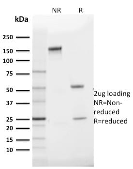 GLUT-1 Monoclonal Mouse Antibody (GLUT1/2475)