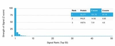 GLUT-1 Monoclonal Mouse Antibody (GLUT1/2475)