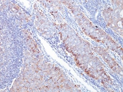 GLUT-1 Monoclonal Mouse Antibody (GLUT1/2476)