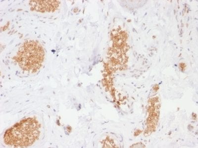 GLUT-1 Monoclonal Mouse Antibody (GLUT1/2476)