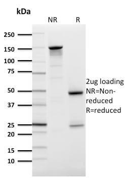 GLUT-1 Monoclonal Mouse Antibody (GLUT1/2476)