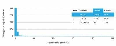 GLUT-1 Monoclonal Mouse Antibody (GLUT1/2476)