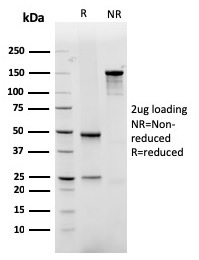 GLUT-1 Recombinant Monoclonal Mouse Antibody (rGLUT1/2476)