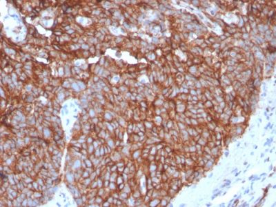GLUT-1 Recombinant Monoclonal Rabbit Antibody (GLUT1/3132R)