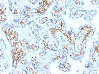 Glutathione S-Transferase Mu1 Monoclonal Mouse Antibody (CPTC-GSTMu1-3)