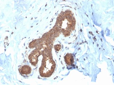 Glutathione S-Transferase Mu2 Monoclonal Mouse Antibody (CPTC-GSTMu2-2)