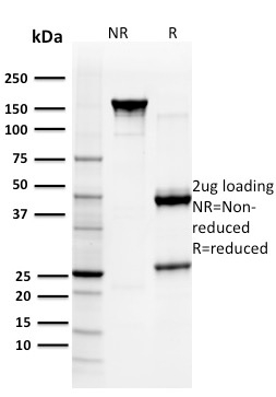 Glutathione S-Transferase Mu3 Monoclonal Mouse Antibody (CPTC-GSTMu3-1)