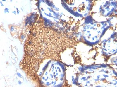 Glycophorin-A / CD235a Monoclonal Mouse Antibody (GYPA/280)