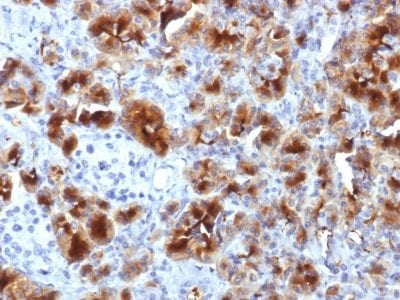 GP2 / ZAP75 Monoclonal Mouse Antibody (GP2/1712)