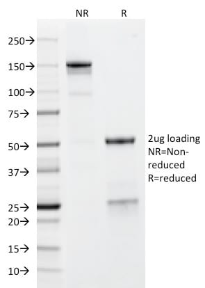 GP2 / ZAP75 Monoclonal Mouse Antibody (GP2/1712)