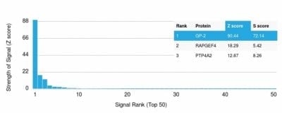 GP2 / ZAP75 Monoclonal Mouse Antibody (GP2/1712)