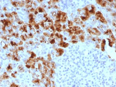 GP2 / ZAP75 Monoclonal Mouse Antibody (GP2/1803)