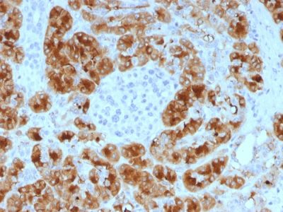 GP2 / ZAP75 Monoclonal Mouse Antibody (GP2/1805)