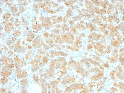 GP2 / ZAP75 Recombinant Monoclonal Rabbit Antibody (GP2/2569R)