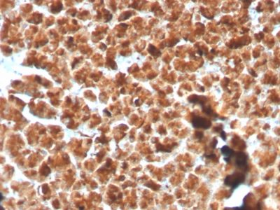 GP2 / ZAP75 Recombinant Monoclonal Rabbit Antibody (GP2/3134R)