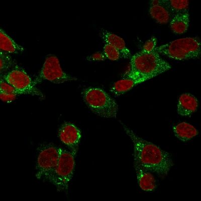 GPX4 / MCSP Monoclonal Mouse Antibody (LHM 2)