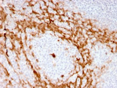 Granulocyte Colony Stimulating Factor Recombinant Monoclonal Rabbit Antibody (CSF3/3166R)