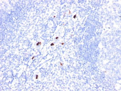 Granulocyte Marker Monoclonal Mouse Antibody (BM-1)