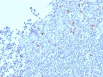 Granzyme B Monoclonal Mouse Antibody (GZMB/2403)