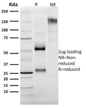 Granzyme B Monoclonal Mouse Antibody (GZMB/2403)