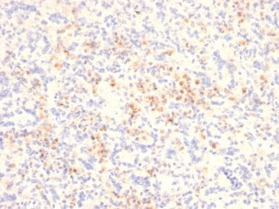 Granzyme B Monoclonal Mouse Antibody (GZMB/2403)