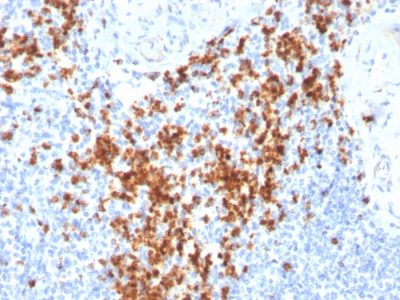 Granzyme B Monoclonal Mouse Antibody (GZMB/3014)