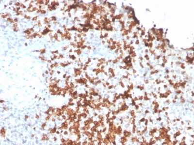 Granzyme B Monoclonal Mouse Antibody (GZMB/3056)