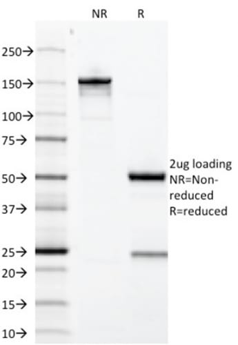 Growth Hormone Monoclonal Mouse Antibody (GH/1371)