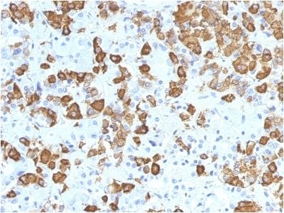 Growth Hormone Monoclonal Mouse Antibody (GH/1371)
