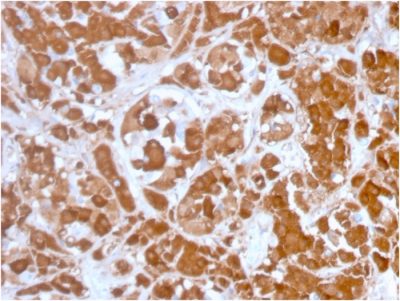 Growth Hormone Monoclonal Mouse Antibody (GH/3155)
