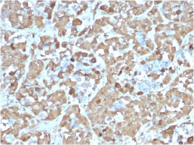 Growth Hormone Recombinant Monoclonal Mouse Antibody (rGH/1450)