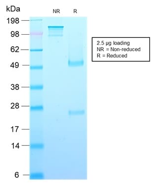 Growth Hormone Recombinant Monoclonal Mouse Antibody (rGH/1450)