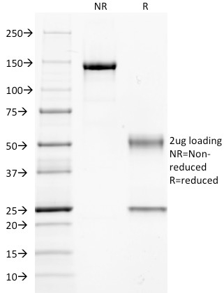 Guanine nucleotide-binding protein Alpha-q / GNAQ / G-Alpha-q Monoclonal Mouse Antibody (GNAQ/2434)