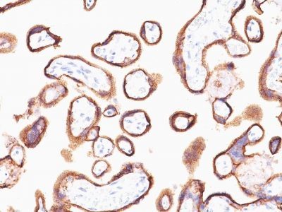 HCG Alpha Monoclonal Mouse Antibody (HCGa/53)