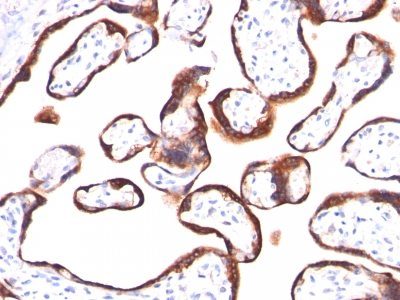 HCG Beta Monoclonal Mouse Antibody (hCGb/459)