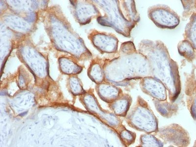 HCG Beta Monoclonal Mouse Antibody (HCGb/54 + HCGb/459)