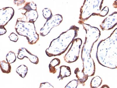 HCG Beta Monoclonal Mouse Antibody (HCGb/54)