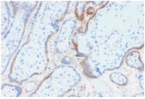 HCG Beta Recombinant Monoclonal Mouse Antibody (rHCGb/54)