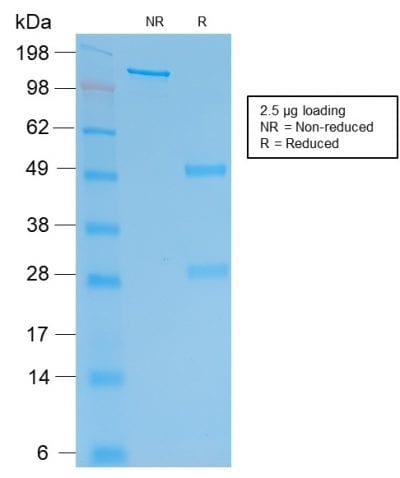 HCG Beta Recombinant Monoclonal Mouse Antibody (rHCGb/54)